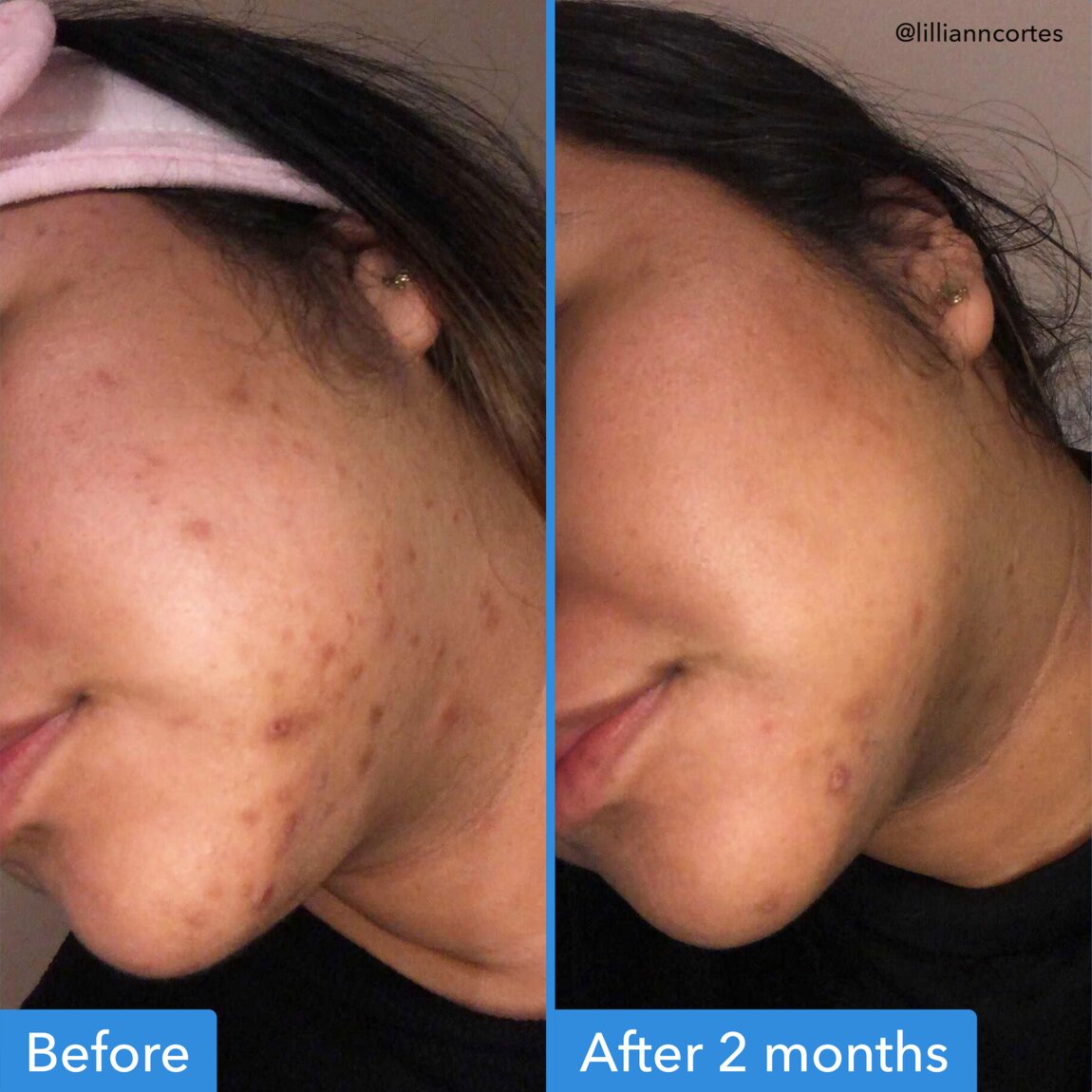discoloration-correcting-serum-o1 zb_p.jpg