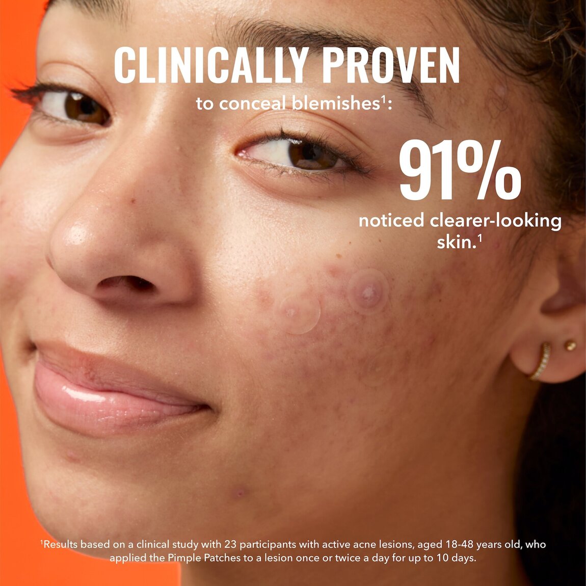 pimple-patches-s9 zb_p.jpg