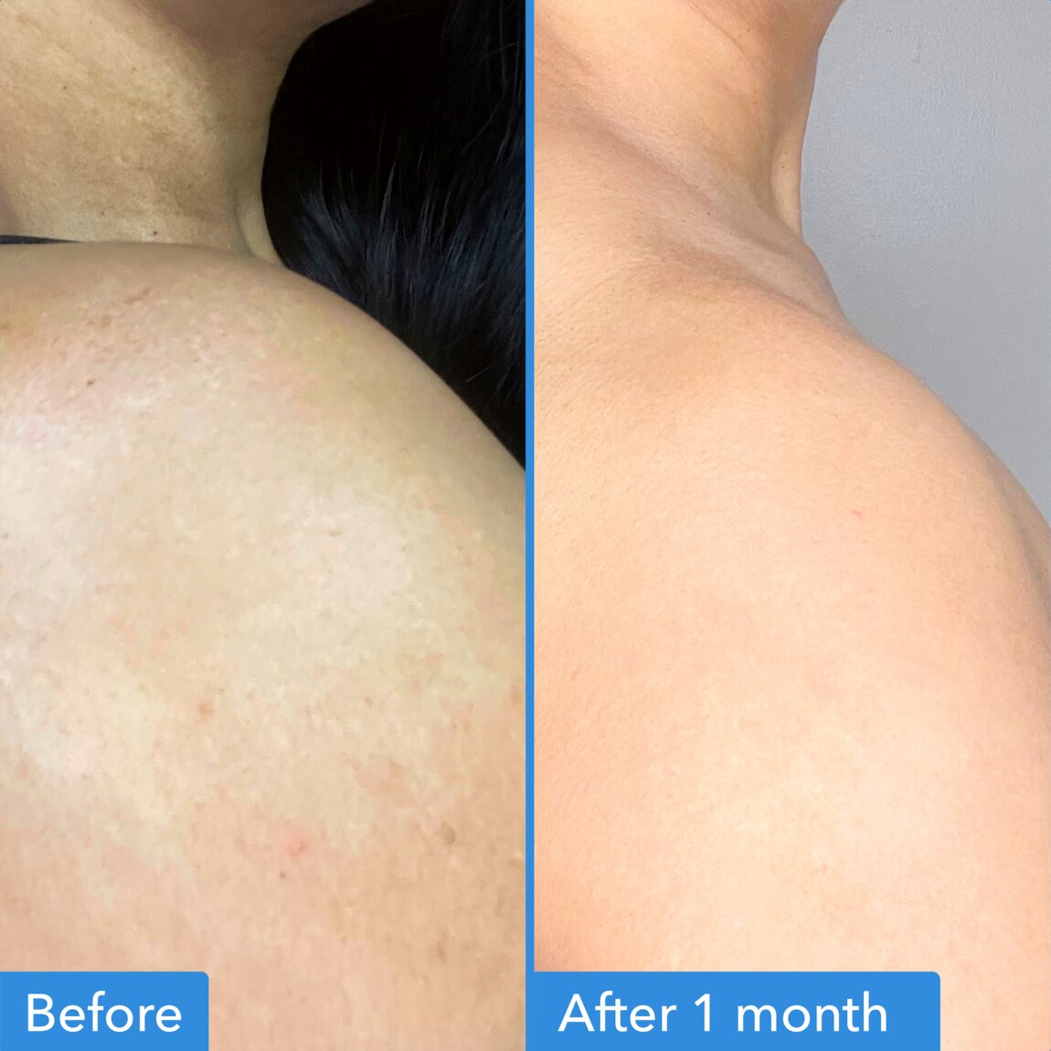 discoloration-correcting-body-treatment-i9 zb_p.jpg